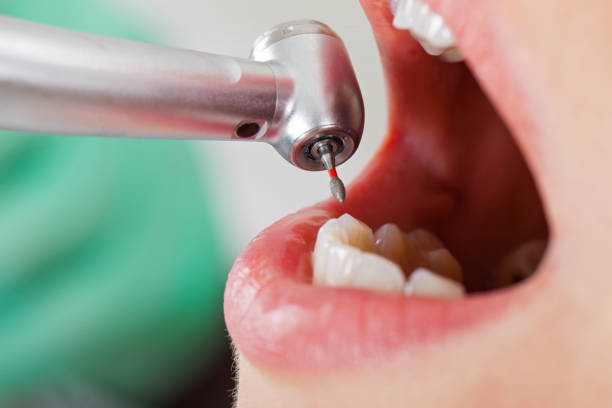Best Emergency Treatment for Toothache in Berlin, NH